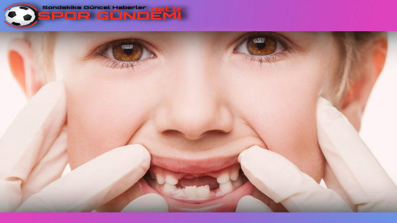 Erken Çocukluk Çağı Çürükleri: Çocuk Sağlığını Tehdit Eden Bir Sorun